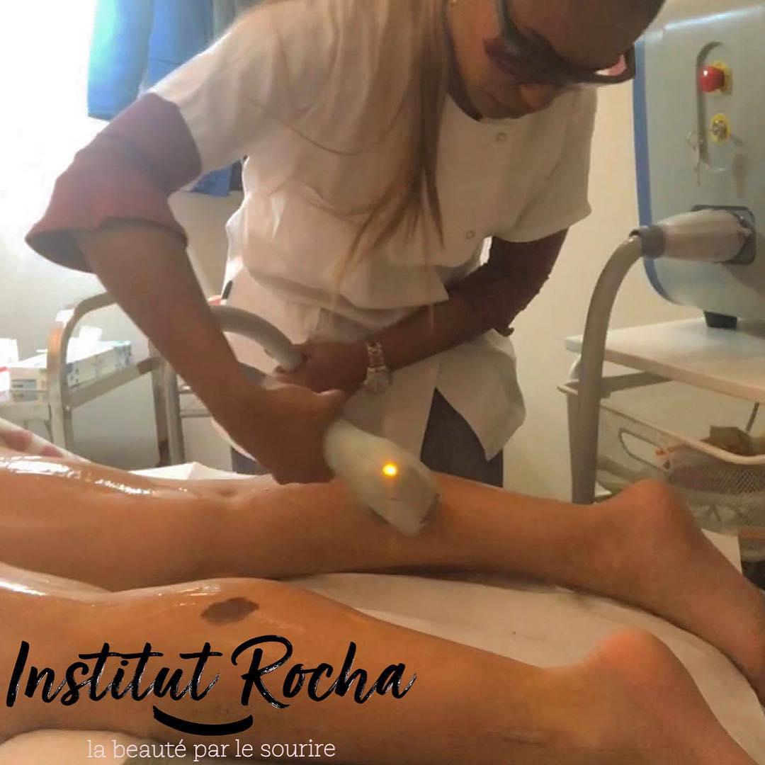 Epilation Laser Diode (sans douleur)