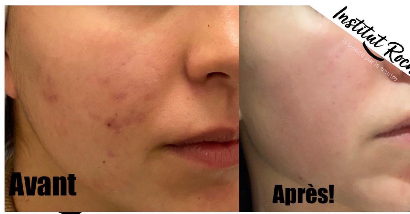 Peeling physique Rose de Mer