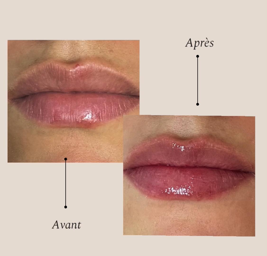 Ari-lips, micropigmentation de levrès naturel.
