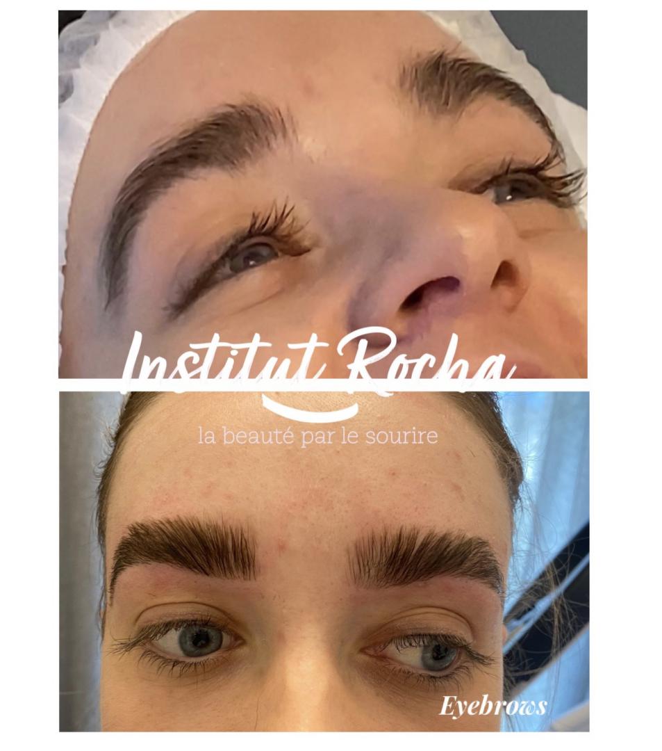 Rehaussement de sourcils